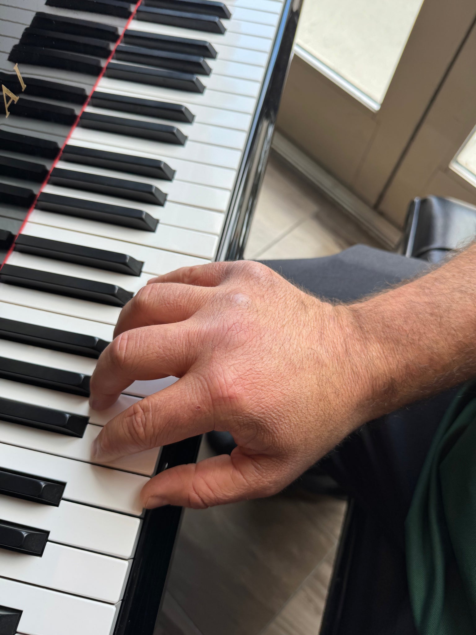 Strong, Supple, and Supported: Strengthening, Compression, and Stretching for the Musician’s Hand